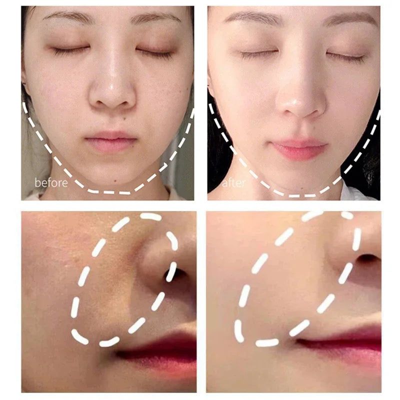 Electric Facial Beauty Devices